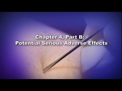 Chapter 4, Part B: Potential Serious Adverse Events