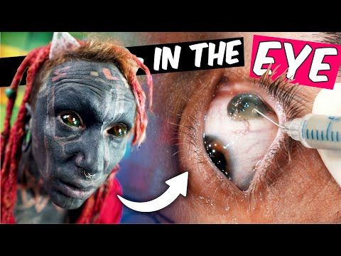 Eyeball Tattoo - All about eye scleral tattooing + Close Up