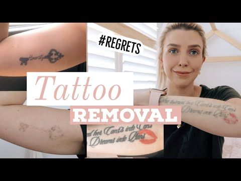 LASER TATTOO REMOVAL/ Before & After/ Best Laser/ COST, PAIN and WHY I'm removing them!