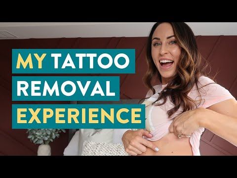 My Tattoo Removal Experience - Tattoo Removal Before And After - Juli Bauer Roth