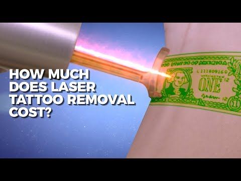 How Much Does Laser Tattoo Removal Cost? | Claudio Explains | Body Details